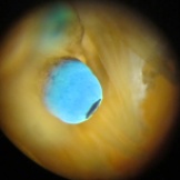 scallop eye